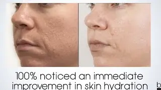 Redness Relief Now!