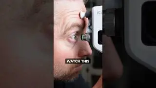 How To Measure Eye Pressure Fast!