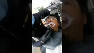 Blanqueamiento Dental en un sola sesión ¿es posible?