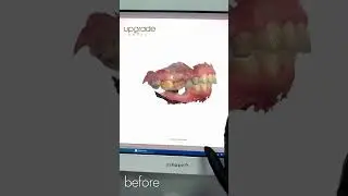 UPGRADE DENTAL