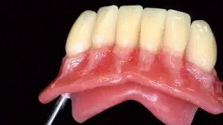 PALA cre-active individualize the denture Heraeus english