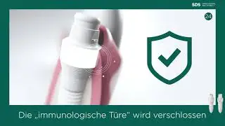 100 Gr&uuml;nde f&uuml;r SDS | #22 - 25 | Die Besonderheiten des SDS Keramik-Implantats Teil 2