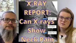 Xray Report: Can X-rays Show Neck Pain | Cervical X-ray Dr. Joshua Nikkanen Dr. Kristina Turkewitsch