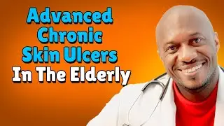 Advanced Chronic Skin Ulcers In The Elderly // Doctor G Explains