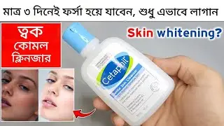 Cetaphil Skin Cleanser: Is It Worth the Hype? 