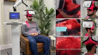 LLLT (Low Level Laser Therapy)Hair Loss Treatment Works Better with Combination Therapy.