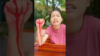 Blood results😥😜 #3ma #funny #comedy
