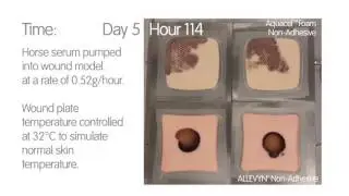 Foam Dressing Comparison - ALLEVYN Non Adhesive vs AquacelTM Foam Non Adhesive