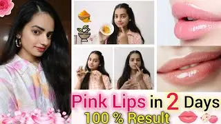 How To Get Pink Lips Naturally 👄 || Get rid of Pigmented Lips | Lip care for Teenagers/Adults 