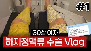 [수술Vlog] 30살에 하지정맥류 수술한 썰 🥶🥶