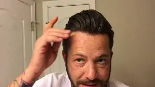 When is your Hairline Ready to be Redone? Also some ranting.  Hair Systme and Hair Replacement