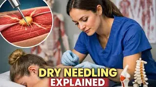 Dry Needling Therapy in Hindi | Scientific Explanation for Physiotherapists