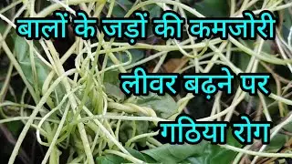 Weak Hair Roots, Enlarged Liver, Arthritis, बालों की जडो़ं की कमजोरी, लीवर बढ़ना, गठिया रोग