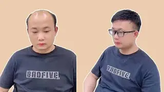 A must-have for men with hair loss, this wig is amazing!