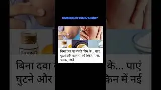 No costly Medicine & Cream use Home remedy | Darkness of Elbow & knee #trending #viral #remedy