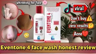 Eventone c face wash review | eventone 4 face wash price