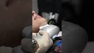 HIFU Treatment: The Secret to Younger, Firmer Skin