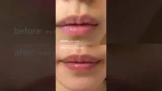 BEFORE AFTER lip mask🌸🥺 why is kbeauty always so ahead?
