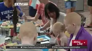 U.S. Charity helps albinos attacked in Tanzania