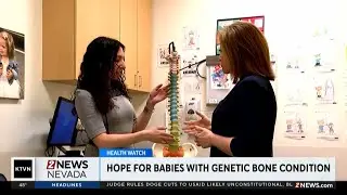 Health Watch: New hope for babies with genetic bone condition