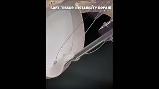 Physical therapy (Soft tissue instability repair, wellness) usa