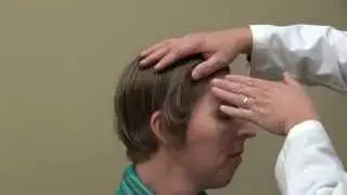 Hair Transplant Result Transgender Woman Feminine Hairline Bald Hair Loss Diep www.mhtaclinic.com