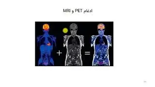 معرفی PET-SCAN