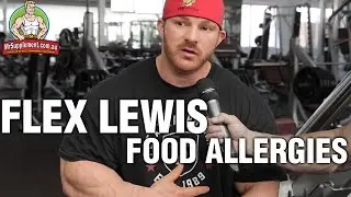 Flex Lewis Has Major Food Allergies