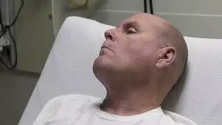 Stylianos Rammos, MD, Discusses the Importance of Fast Treatment for Strokes