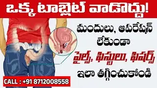 Free Doctor Consultation | Piles Lady Specialist Doctor | Best Piles Treatment | Piles Remedy #piles