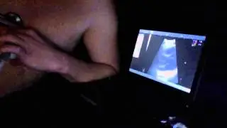 Ultrasound (echo), with sound of male heart