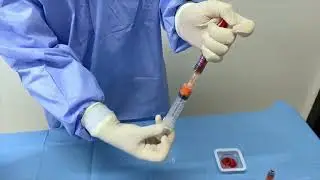 SVF технология использование