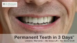 Brian has taken a drastic step to fly from Olathe, USA for full mouth dental implant in India
