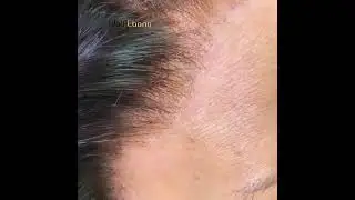Who can see the lace and knots? Invisible HD lace front wig with mini single knots lace wig #shorts