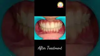 A beautiful transformation begins with a confident smile | Chhattisgarh Dental Hospital