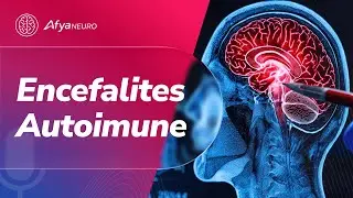 Encefalites Autoimune