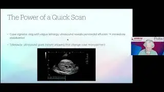 20251021 Mindray/Probo Webinar - Loyer