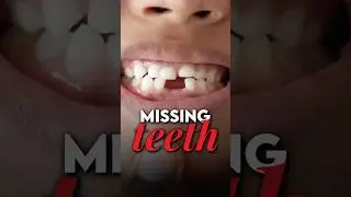 Dental Implants vs Dentures Fairfax VA - What's Best for Missing Teeth? | DentCare Now Explains