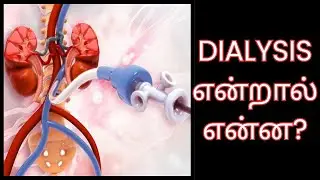 Dialysis Treatment Explained | Kidney Failure & Dialysis in Tamil | டயாலிசிஸ் என்றால் என்ன?