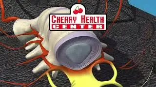 How Spinal Decompression Solves Back & Neck Pain | Ozarks Expert Chiropractor
