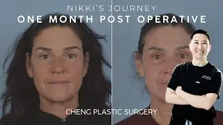 SURGICAL JOURNEY Part 5:  Nikki’s One Month Post-Op