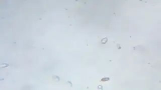 Cyclidium？