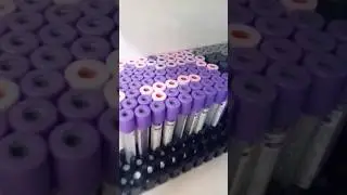 medical pathology #bloodtest #pathology #bloodtests #medical #lal #path #lab #shortvideo #viralvideo