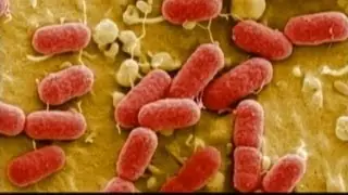 Health Alert: Massive Meat Recall