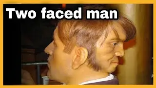 two faces man | mysterious man | Edward mordake | #shorts