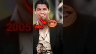CR7&rsquo;s Smile Journey 😁🔥 | Teeth Evolution #football #ronaldo #viral #goat #youtubeshorts #shorts