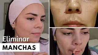 💁‍♀️¿Cómo ELIMINAR MANCHAS de MELASMA en la Cara? Maquillaje NATURAL