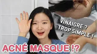 Acné Masque • SE DÉBARASSER DE L’ACNÉ AVEC DU VINAIGRE !│Jungkook BTS fait également cela.