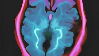 Neurobiological Risk Factors for Violence Part 1 (Forensic Psychology, Spring 2024)