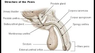 Rupture of the Corpus Spongiosum and Spongy urethra and extravasation of urine into anterior abdomin